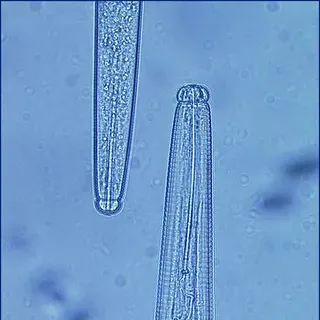 thumbnail for publication: Nematode ID and Diagnostics